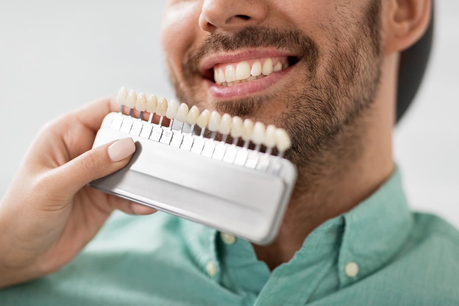 Everything You Need to Know About Dental Veneers