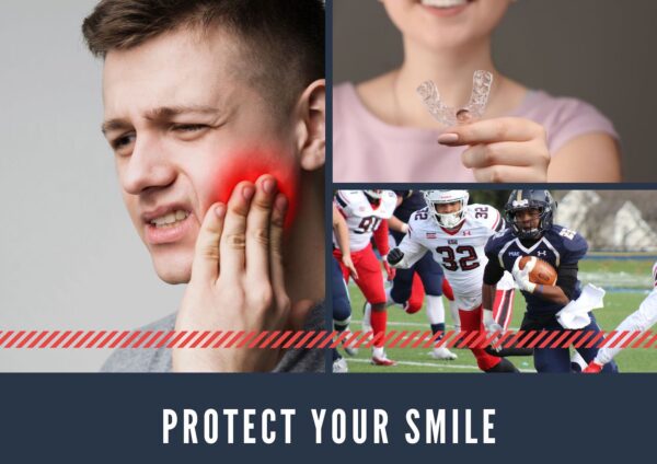 mouthguards image