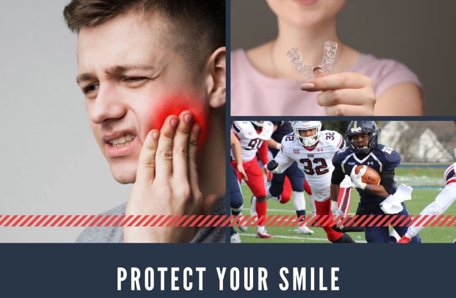 mouthguards image